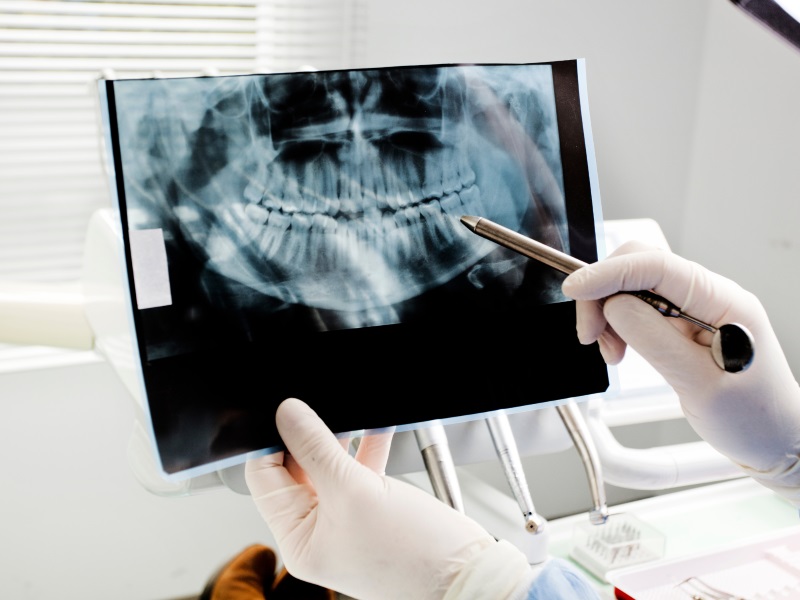 dental_xray