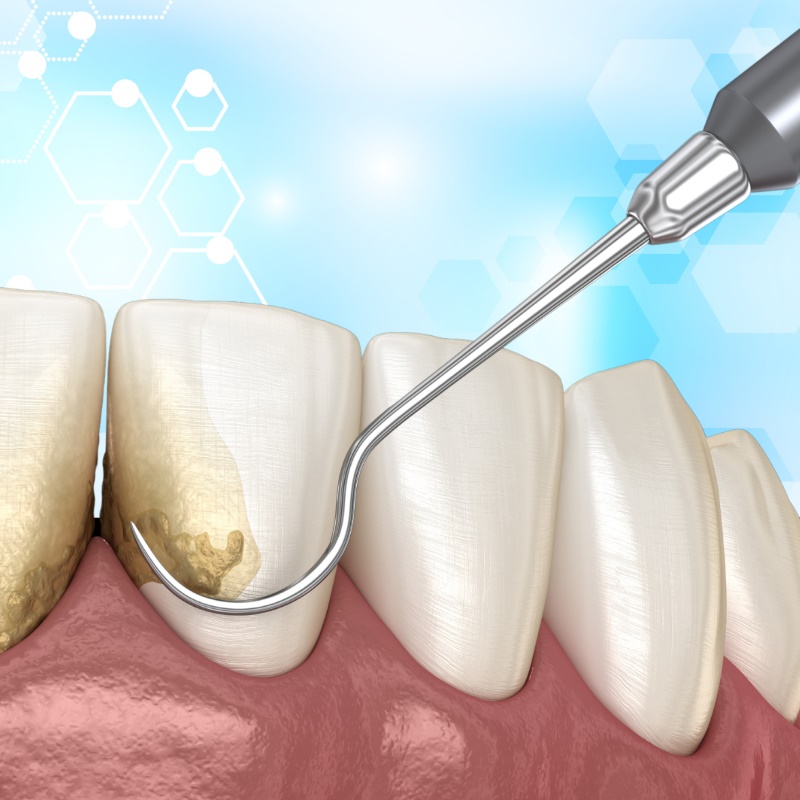 dental_xray